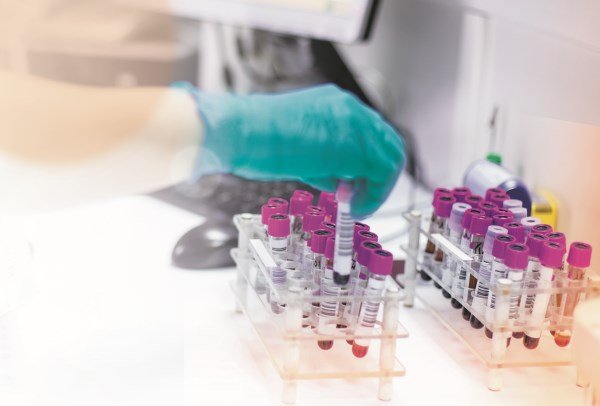 © Siemens Healthineers
